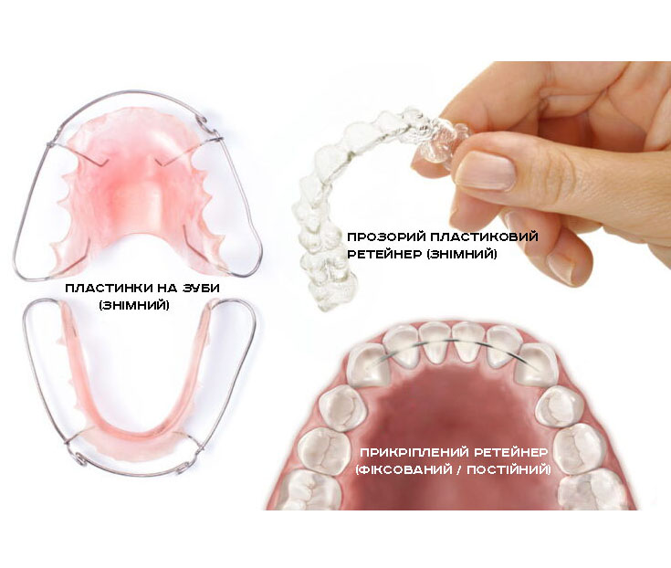 Dentist is checking up a patient with an ortodental system